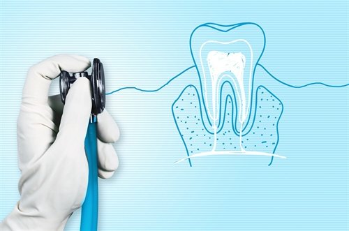 Come prendersi cura dei propri denti e mantenerli in salute